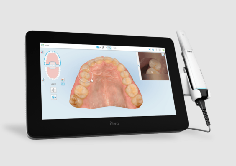 Scanner iTero Lumina sur tablette