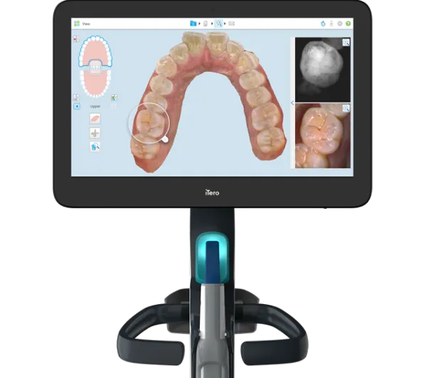 Scanner intra-orale iTero